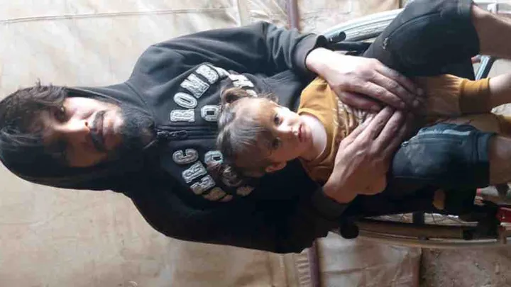 Support Mohamad’s Spine Surgery